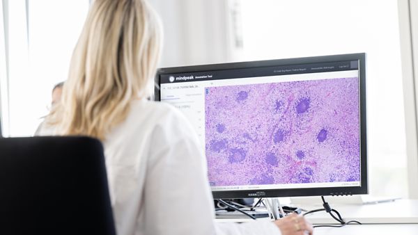 Frau sitzt am Computer und entschlüsselt mithilfe von Mindpeak Gewebe.